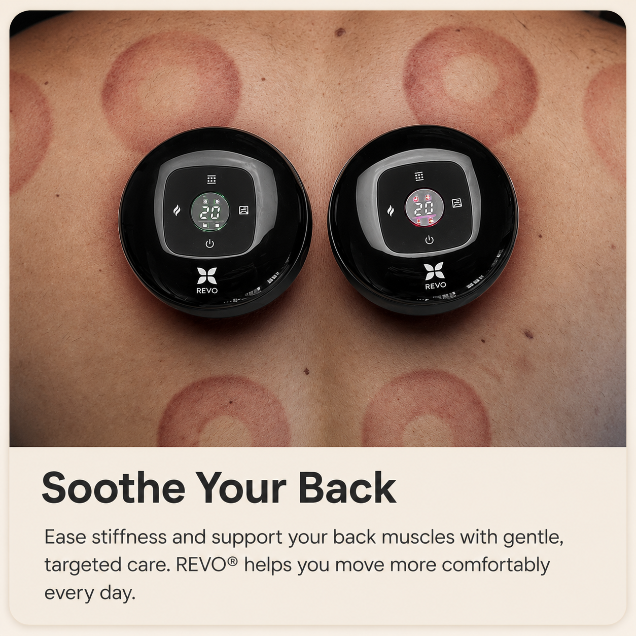 REVO™ Smart Cupping Therapy Massager
